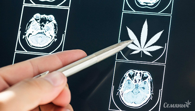 Эпилепсия и КБД