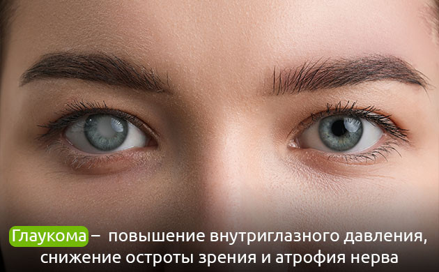 Повышение внутриглазного давления: признак глаукомы